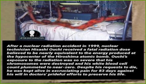 **The Remarkable Journey Of Hisachi Ouchi After Radiation**